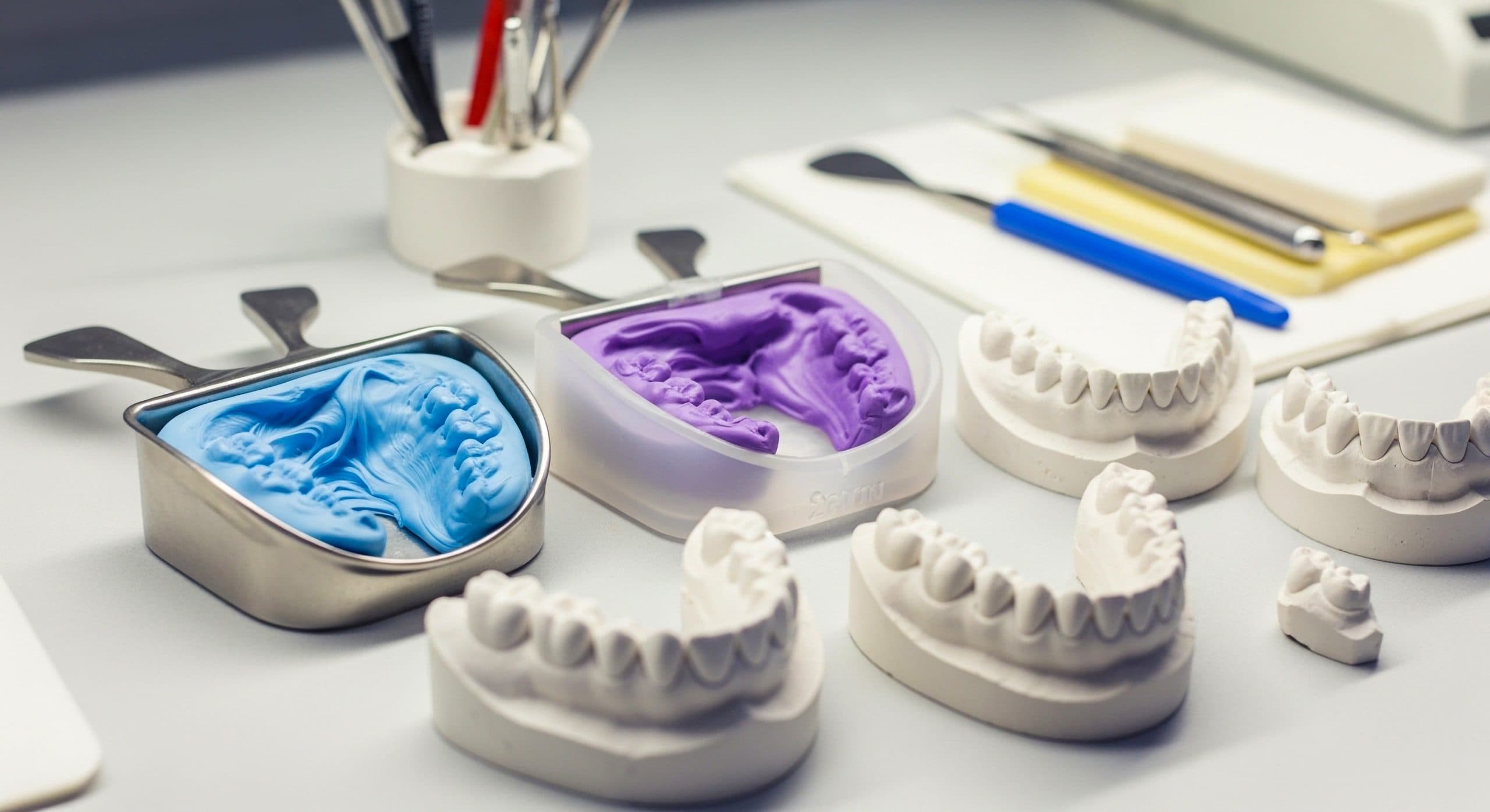 Traditional dental impressions in blue and purple material alongside white dental casts
