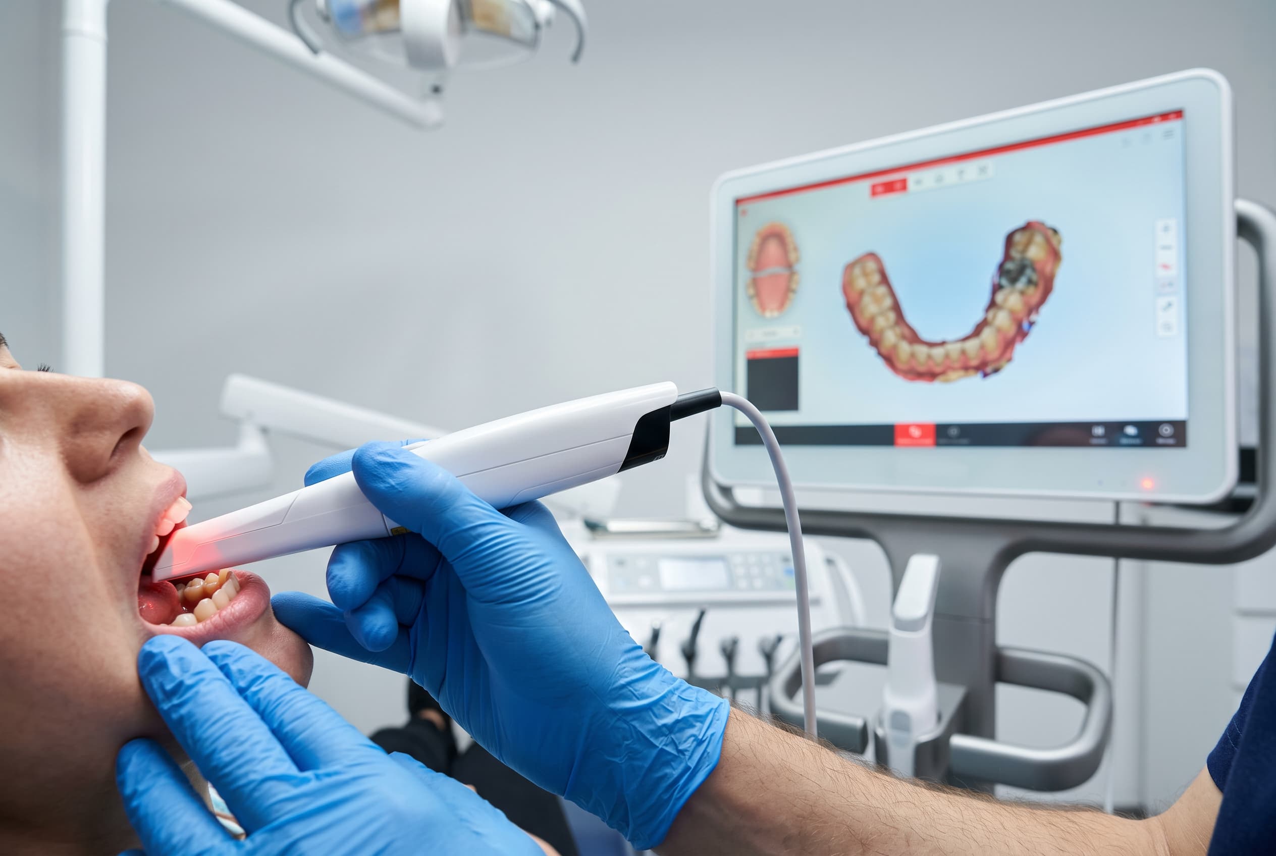 Clinician capturing digital dental impressions with an intraoral scanner while a dental arch appears on screen