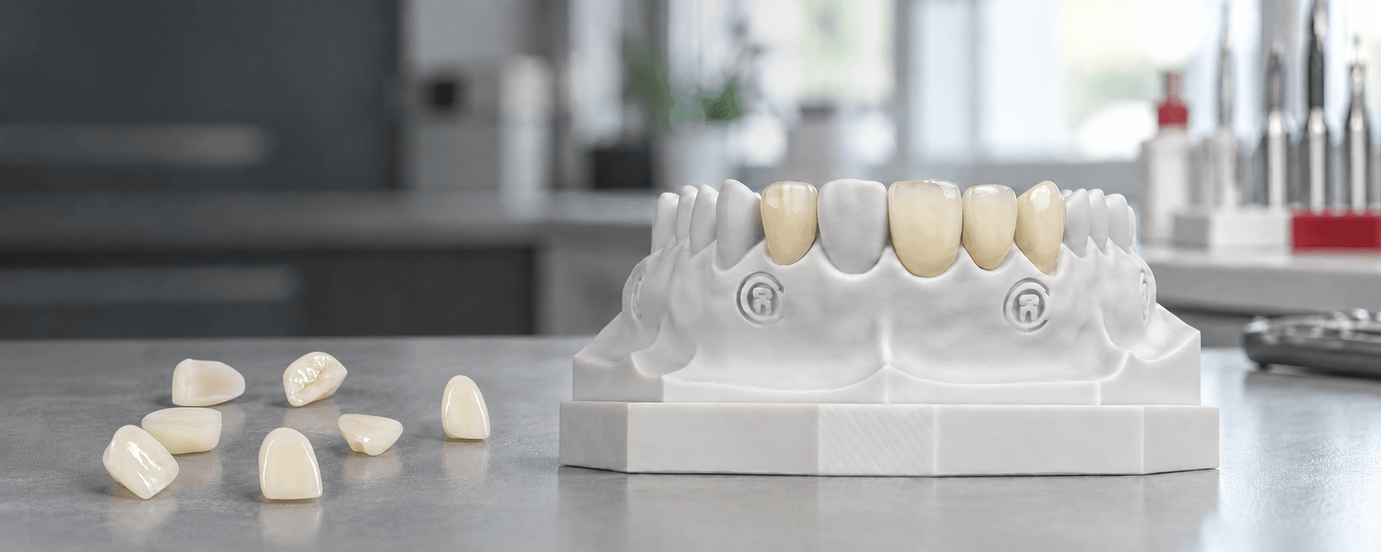 Tooth-colored dental crowns displayed on a transparent dental model in a laboratory