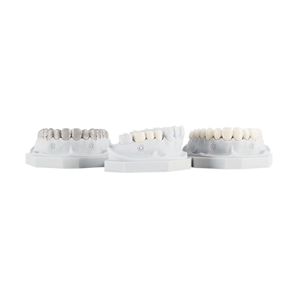 Crowns & Bridges gallery image 1