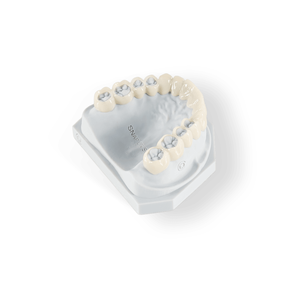 Snap-On Smile