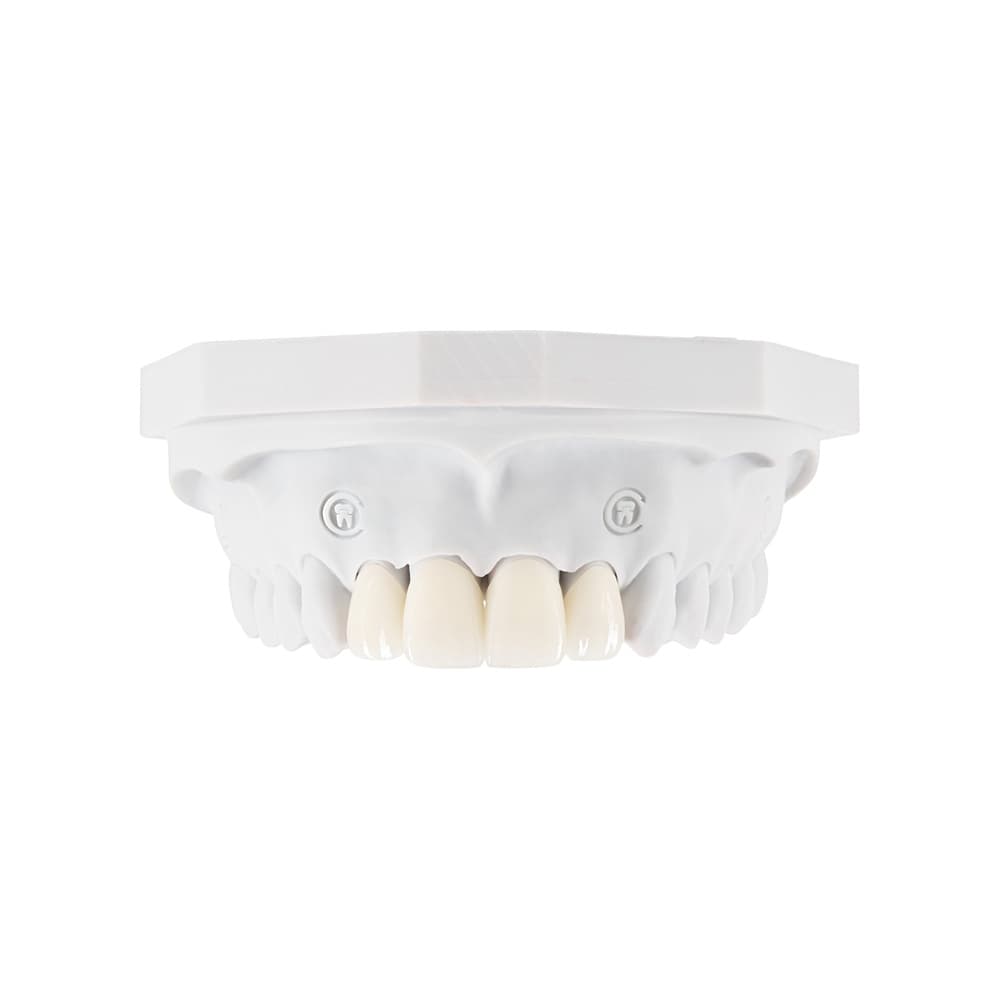 Veneers gallery image 4