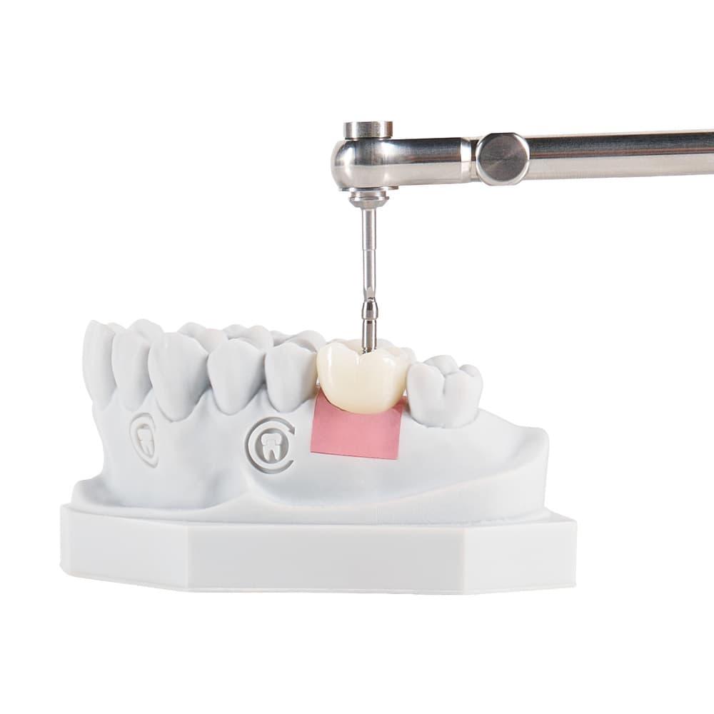 Screw-Retained gallery image 1