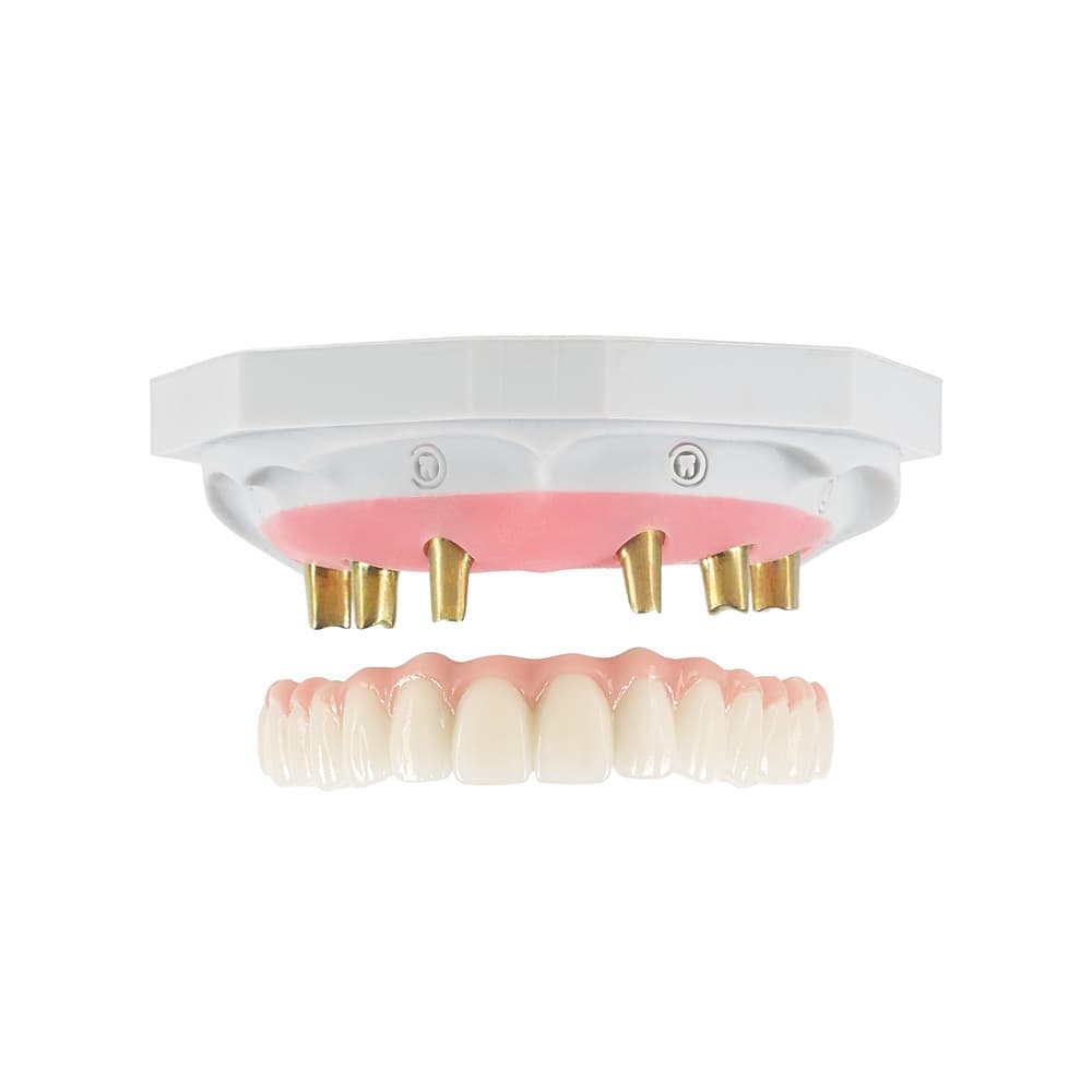 Screw-Retained gallery image 2
