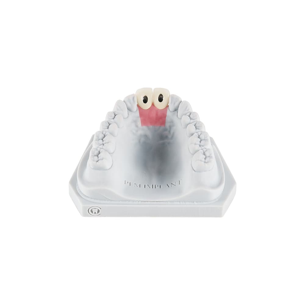 Screw-Retained gallery image 4