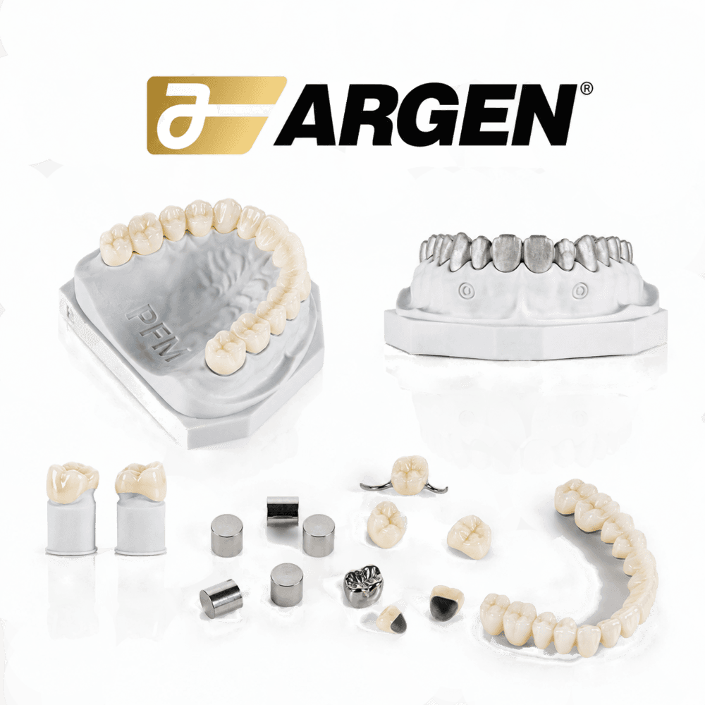 PFM (Argen® alloy)