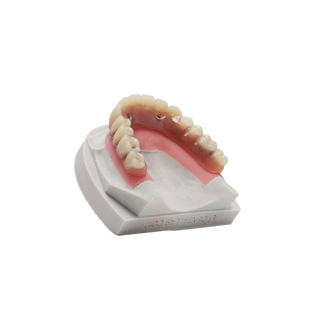 NeoFix™ gallery image 4