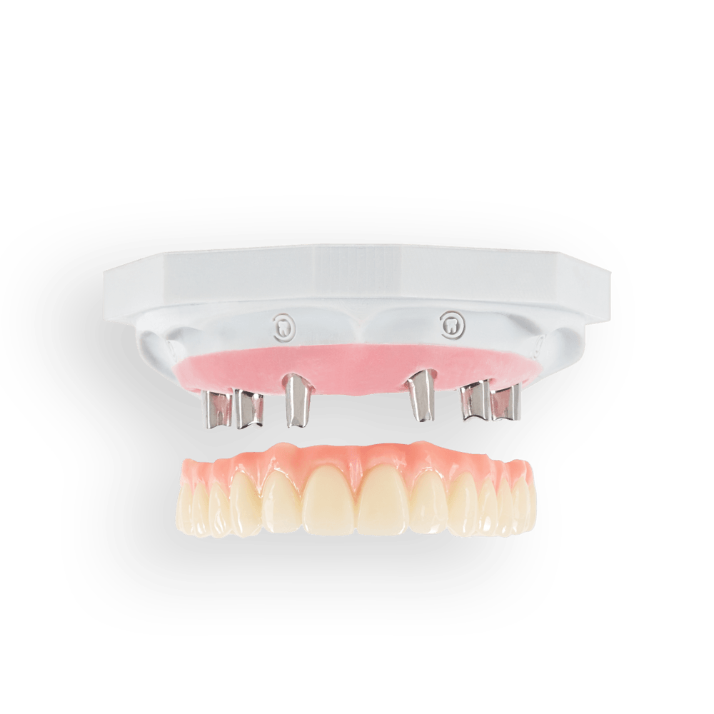NeoTemp restoration