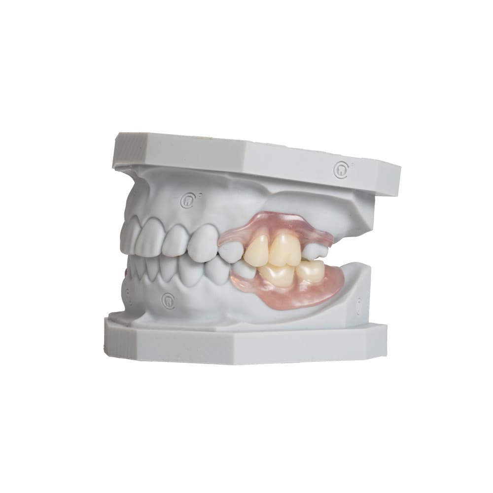 Flexible Partials (TCS™) gallery image 1