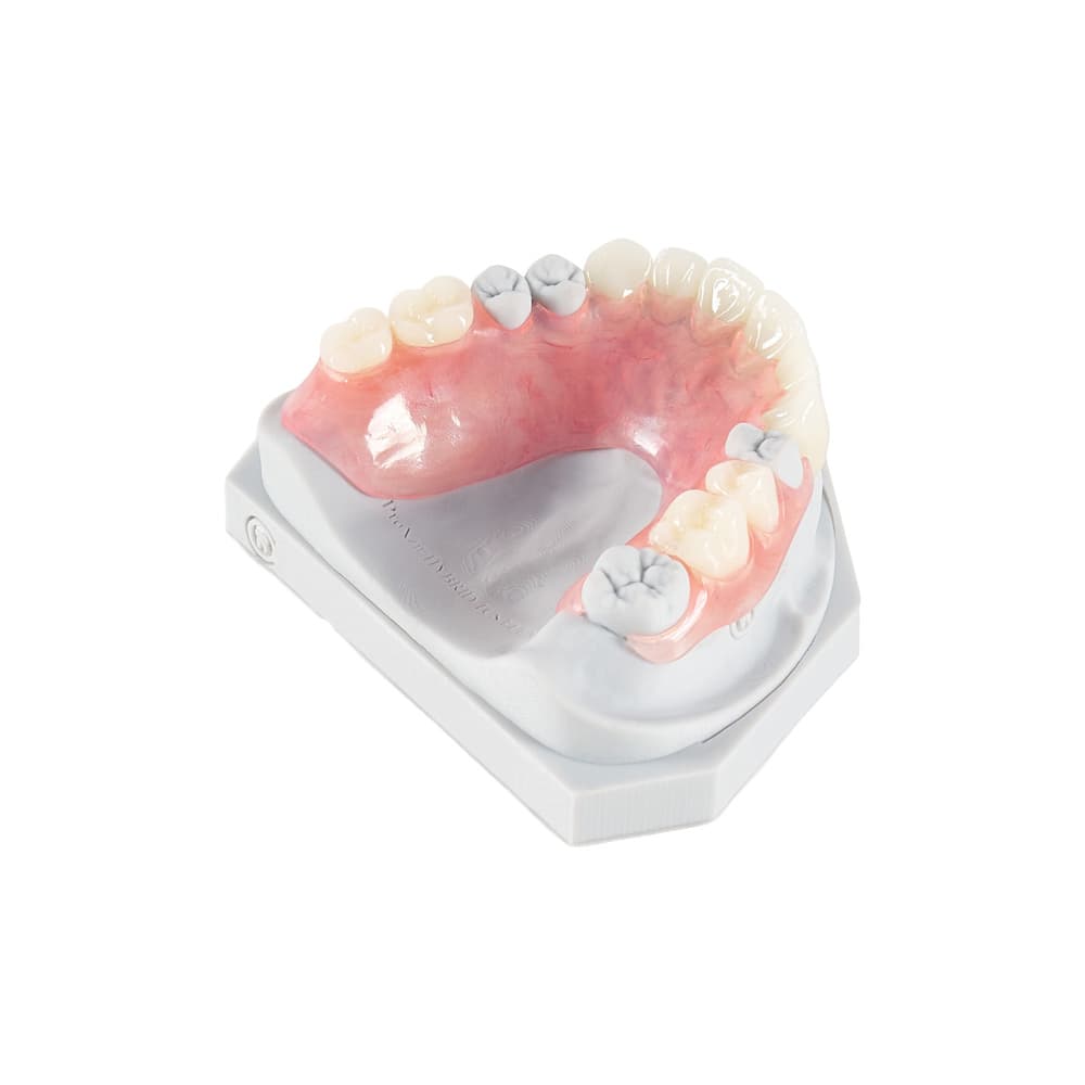 Flexible Partials (TCS™) gallery image 2