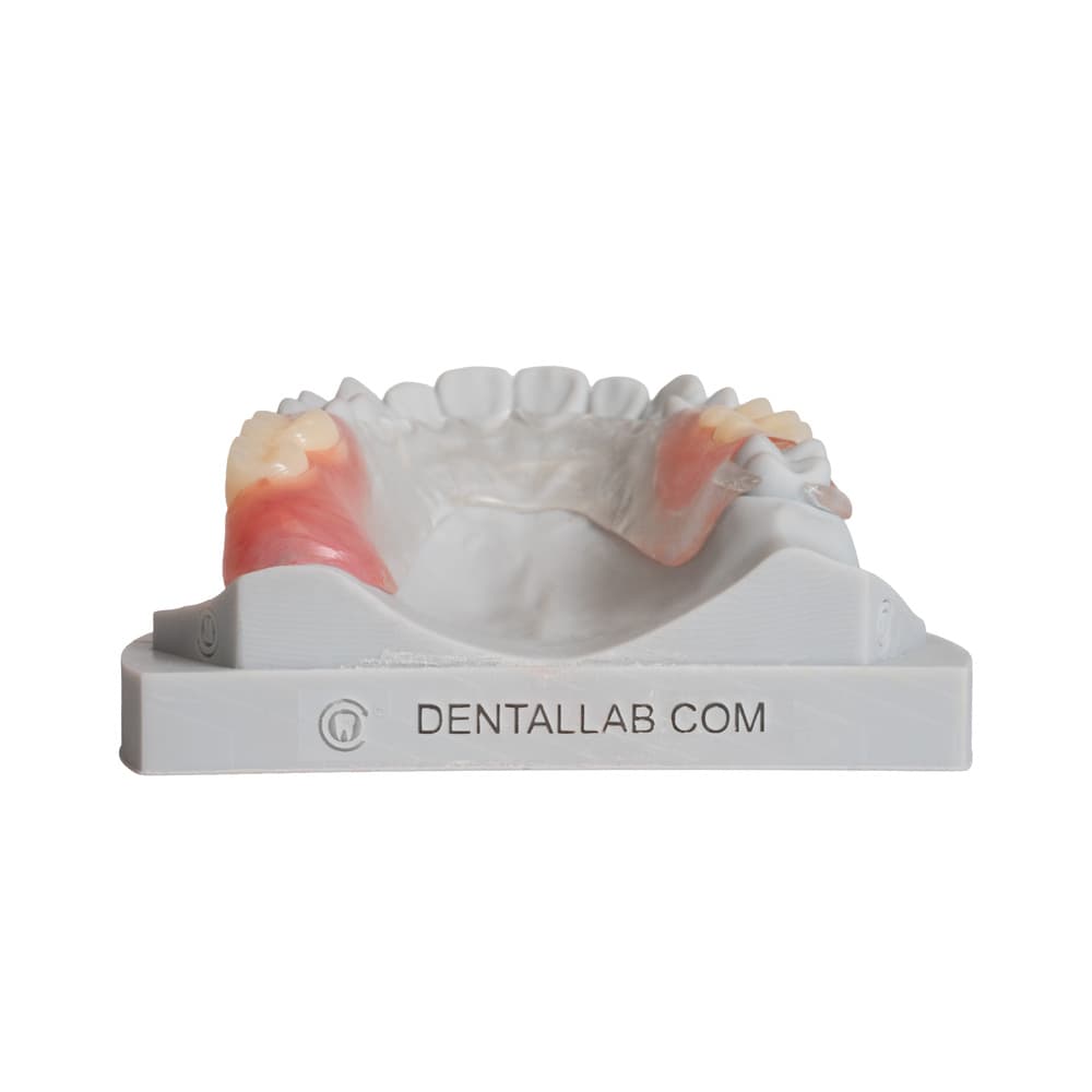 Flexible Partials (TCS™) gallery image 4
