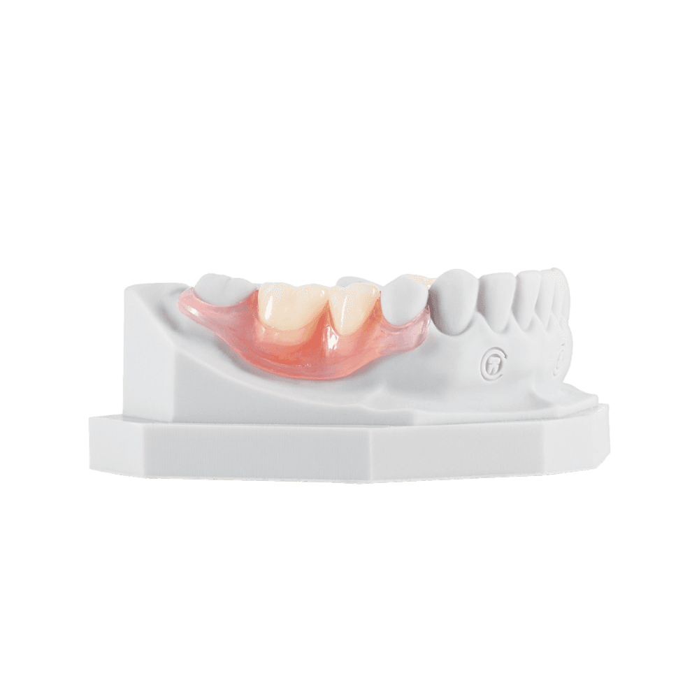 TCS Flexi Flipper (up to 3 teeth)
