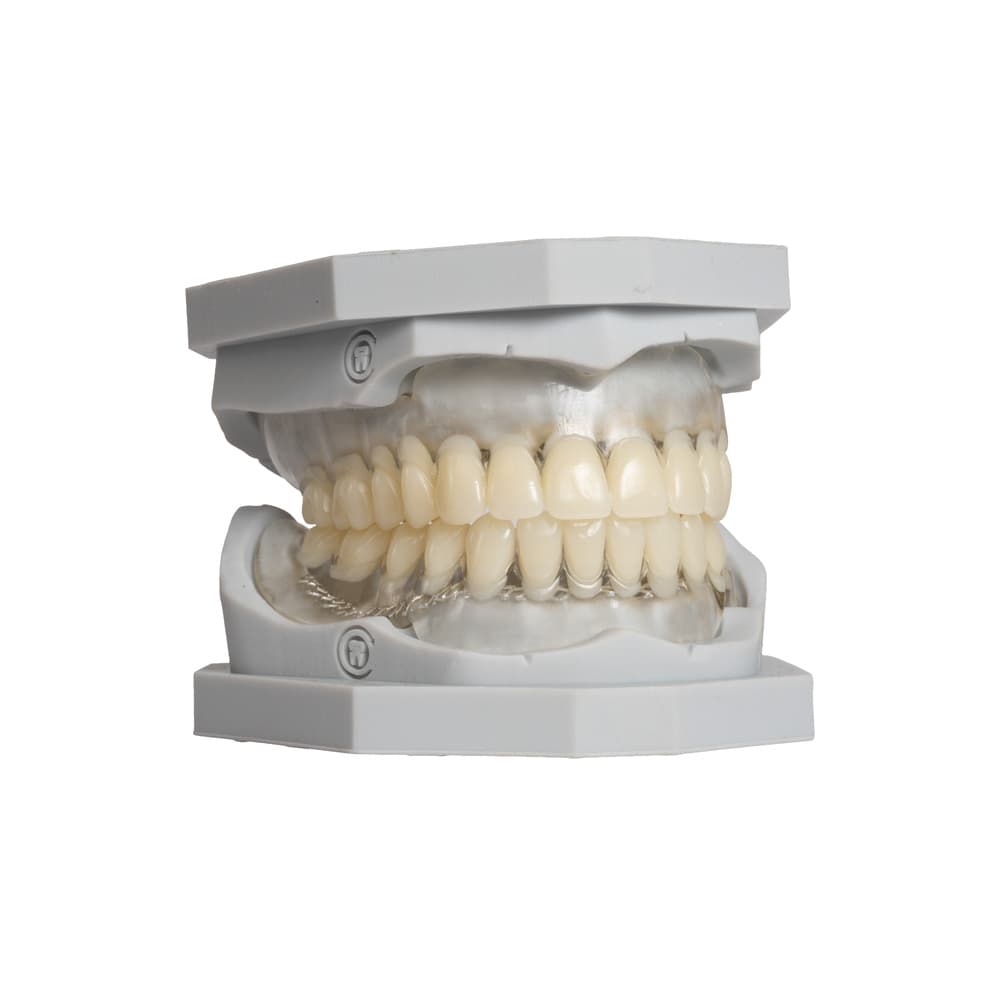 Full Denture gallery image 3