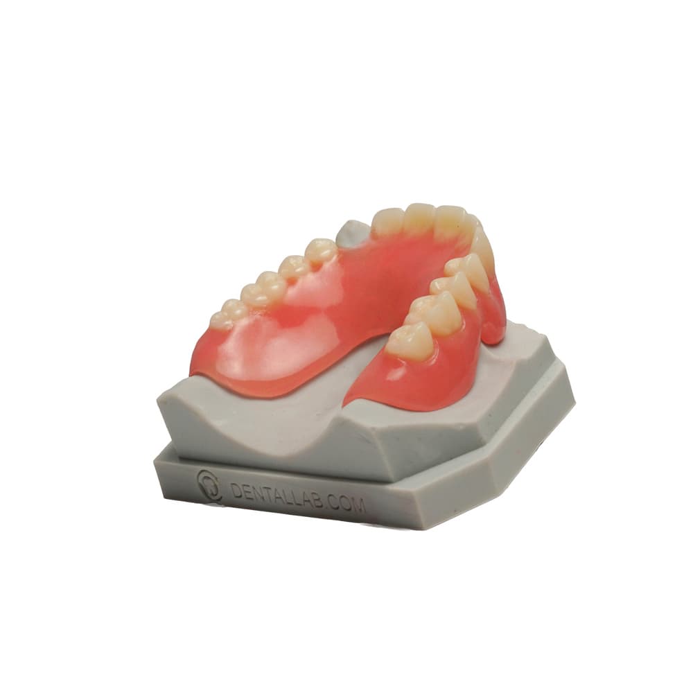 Full Denture gallery image 4