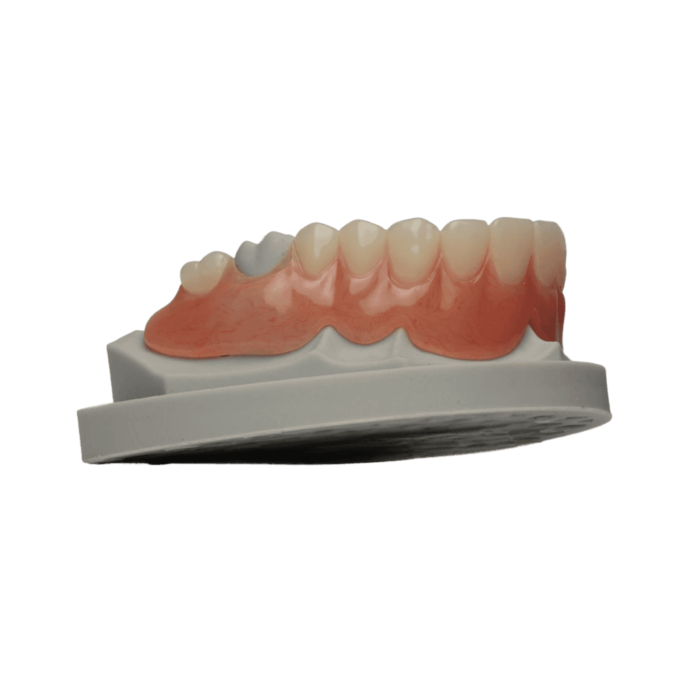 Cu-Sil Denture