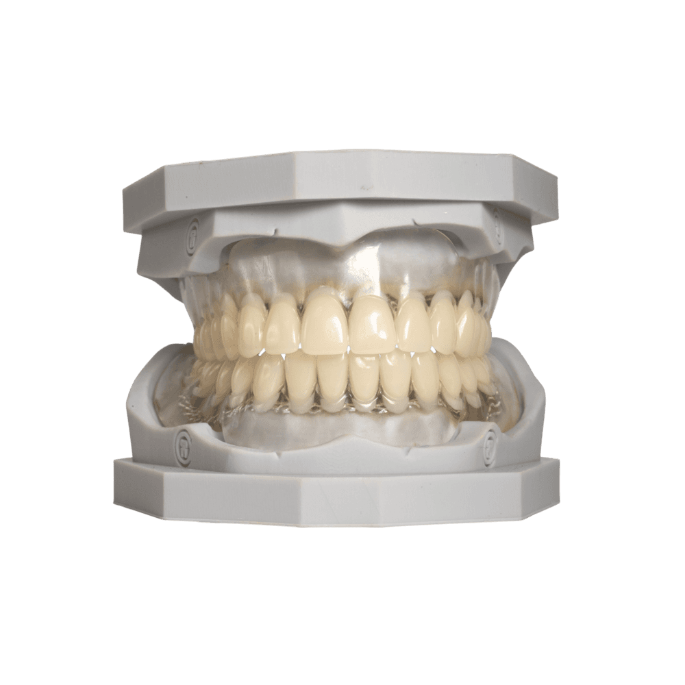 Clear Full Denture