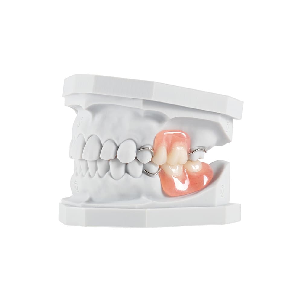 Partial Denture gallery image 1