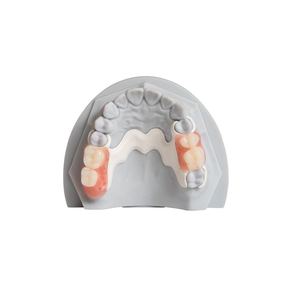 Partial Denture gallery image 2