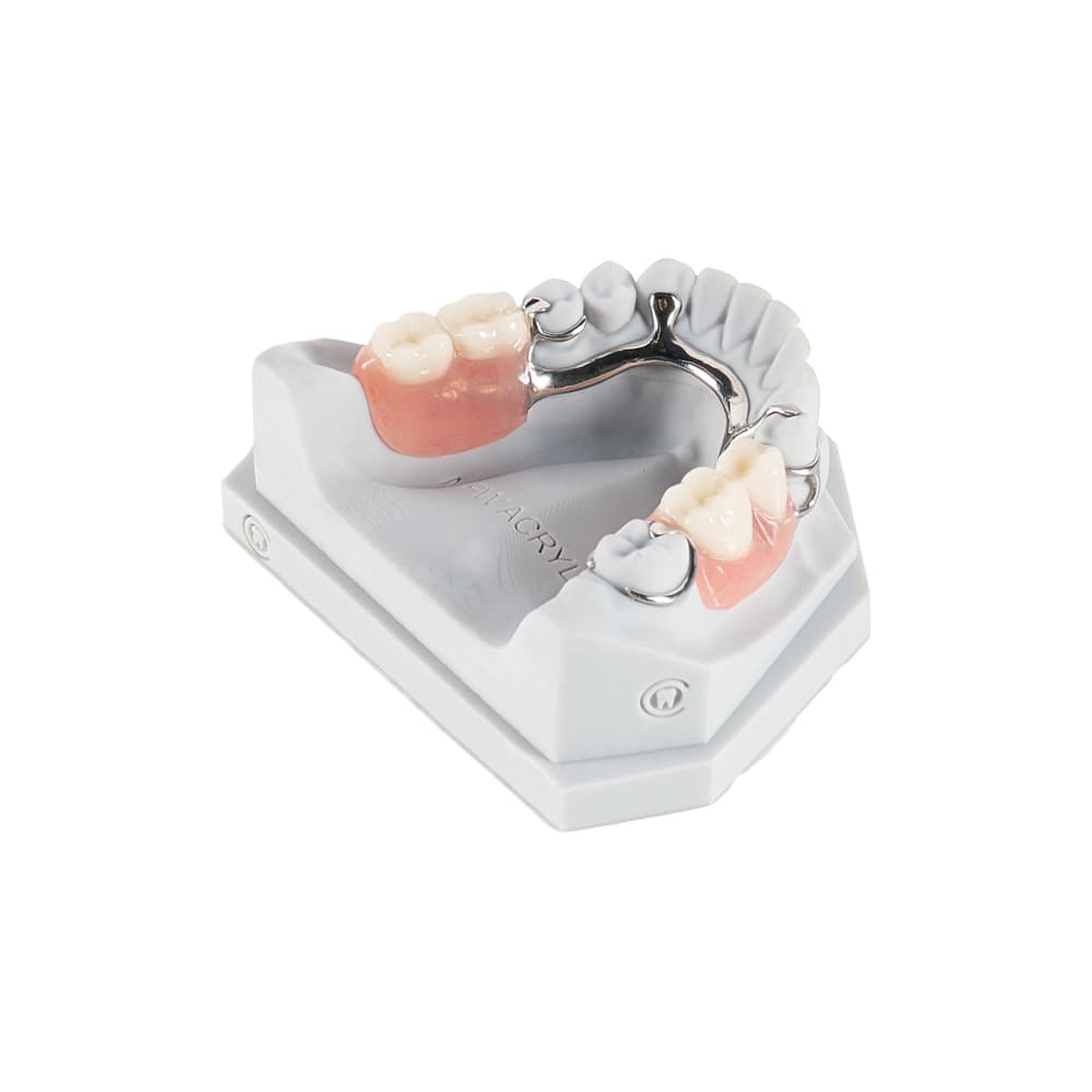 Partial Denture gallery image 3