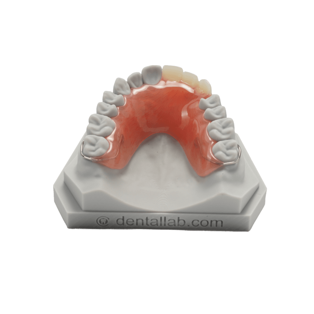 Acrylic Flippers (up to 3 teeth)