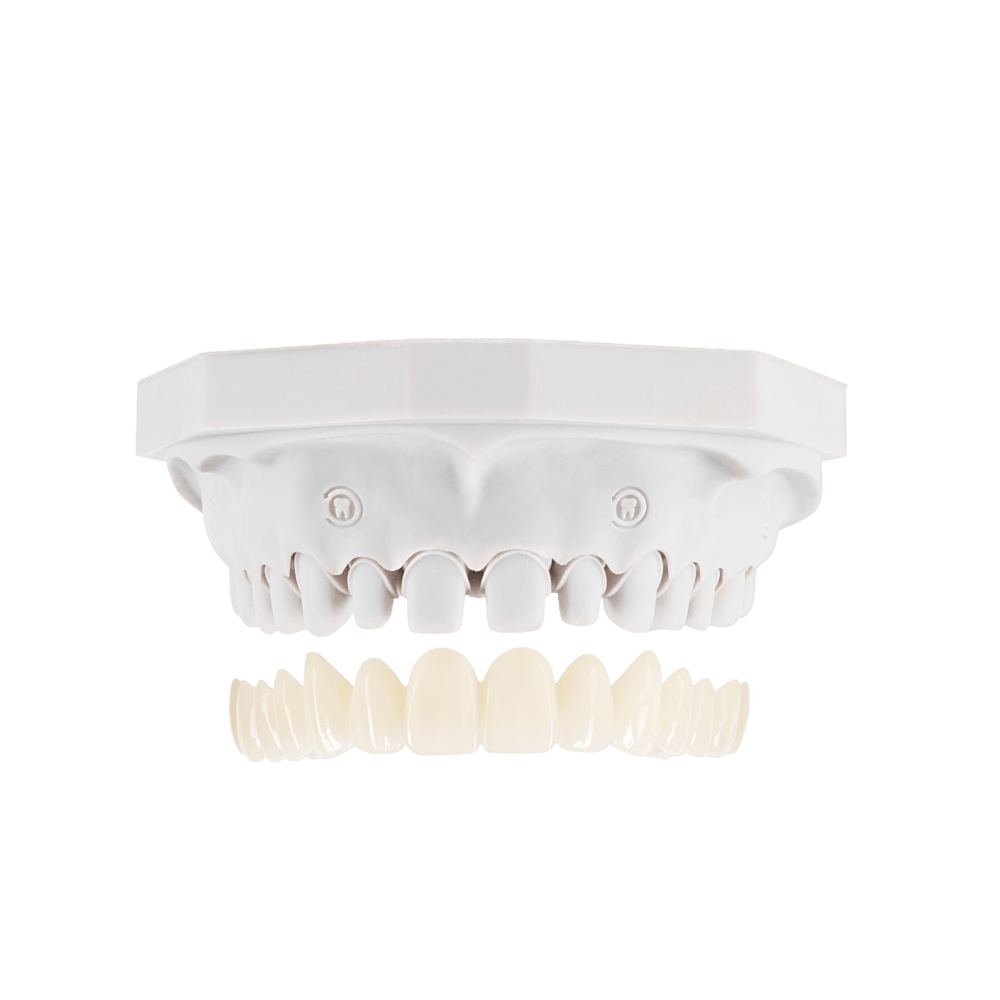 Crown and bridges restoration