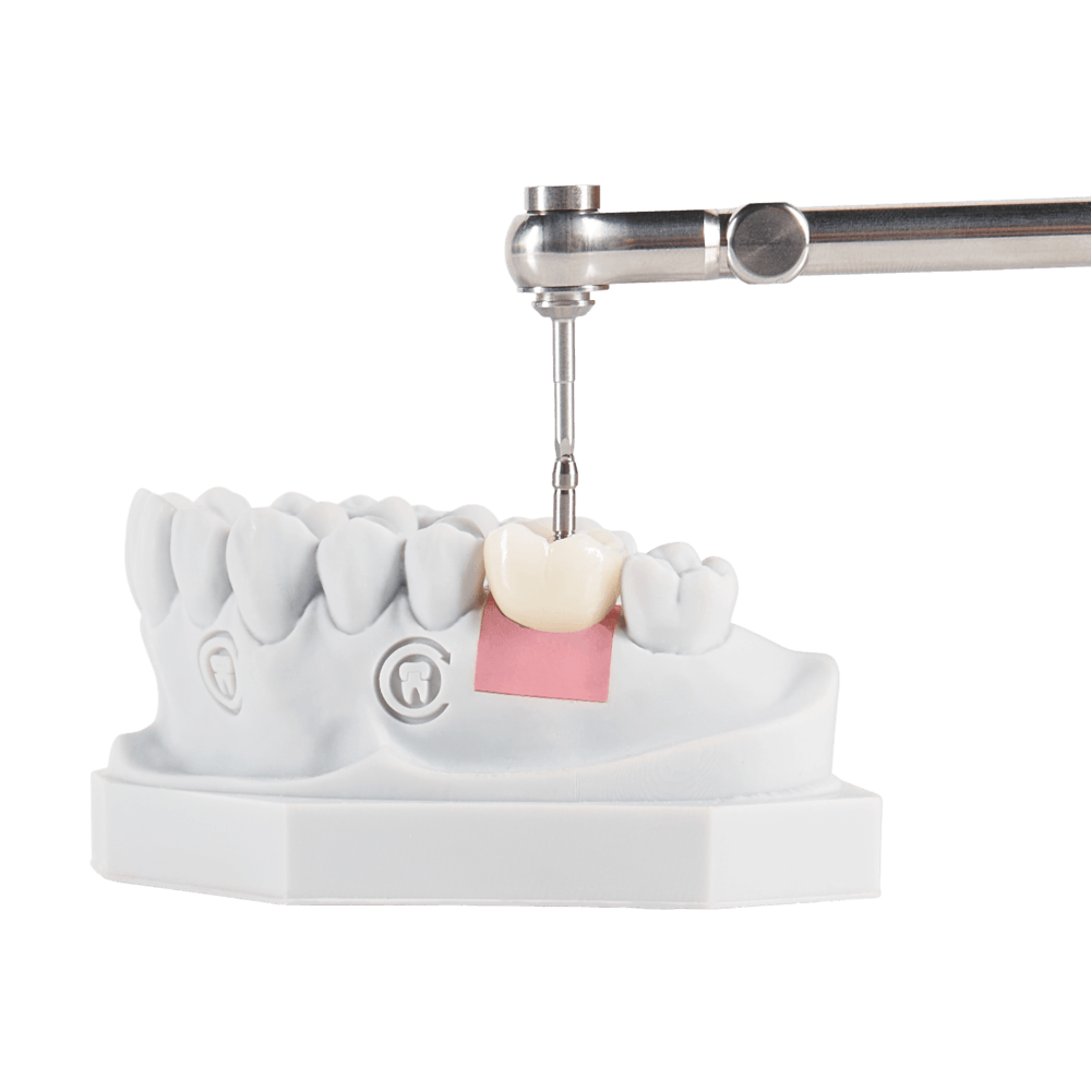 Full-arch implant restoration