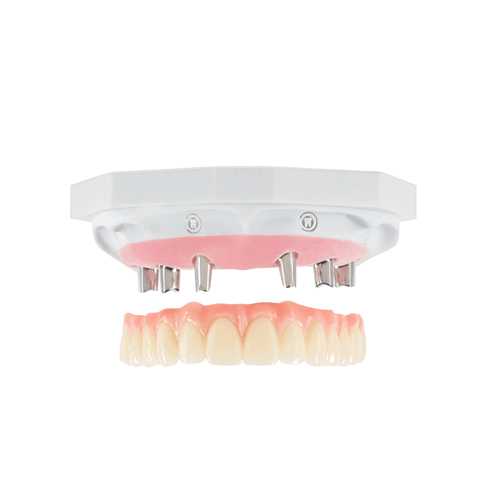 NeoPrep restoration