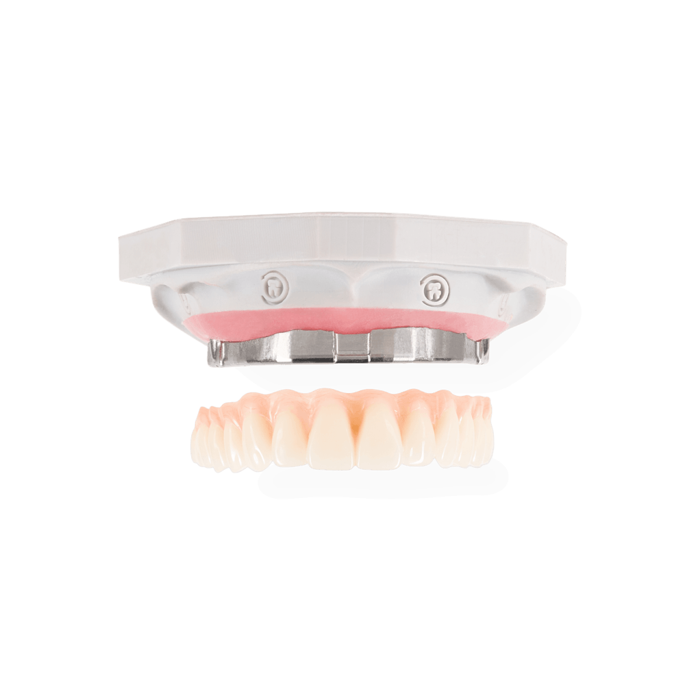 NeoClip restoration