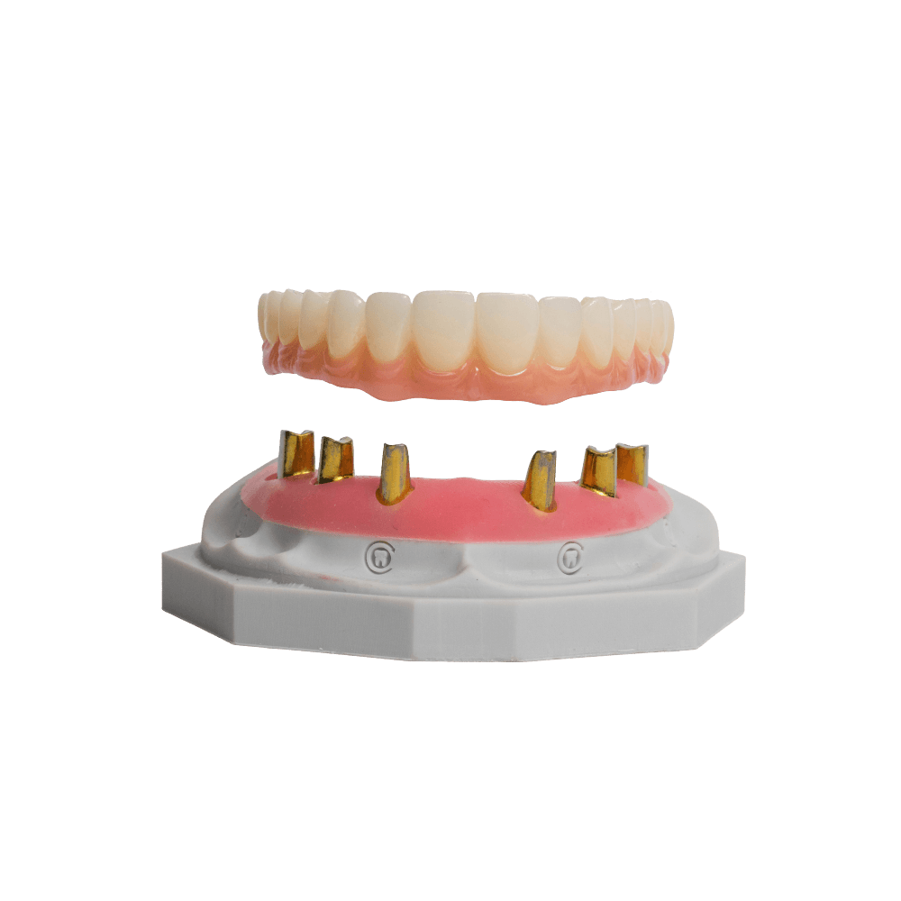 NeoSnap restoration
