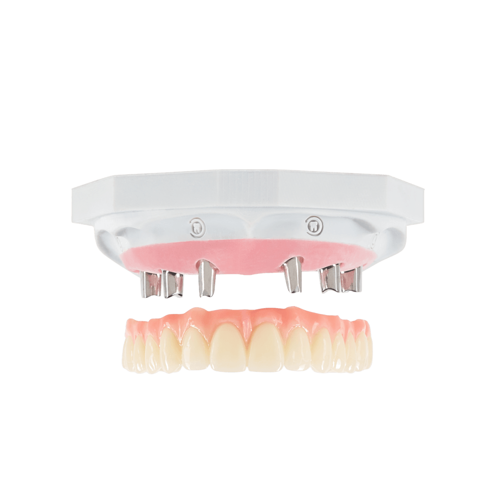 NeoTemp restoration