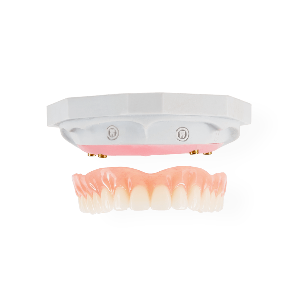 NeoSnap restoration
