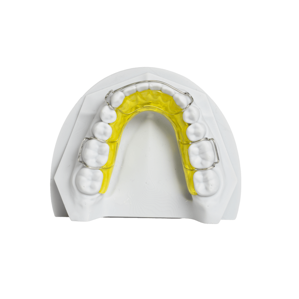 Fixed bonded retainer