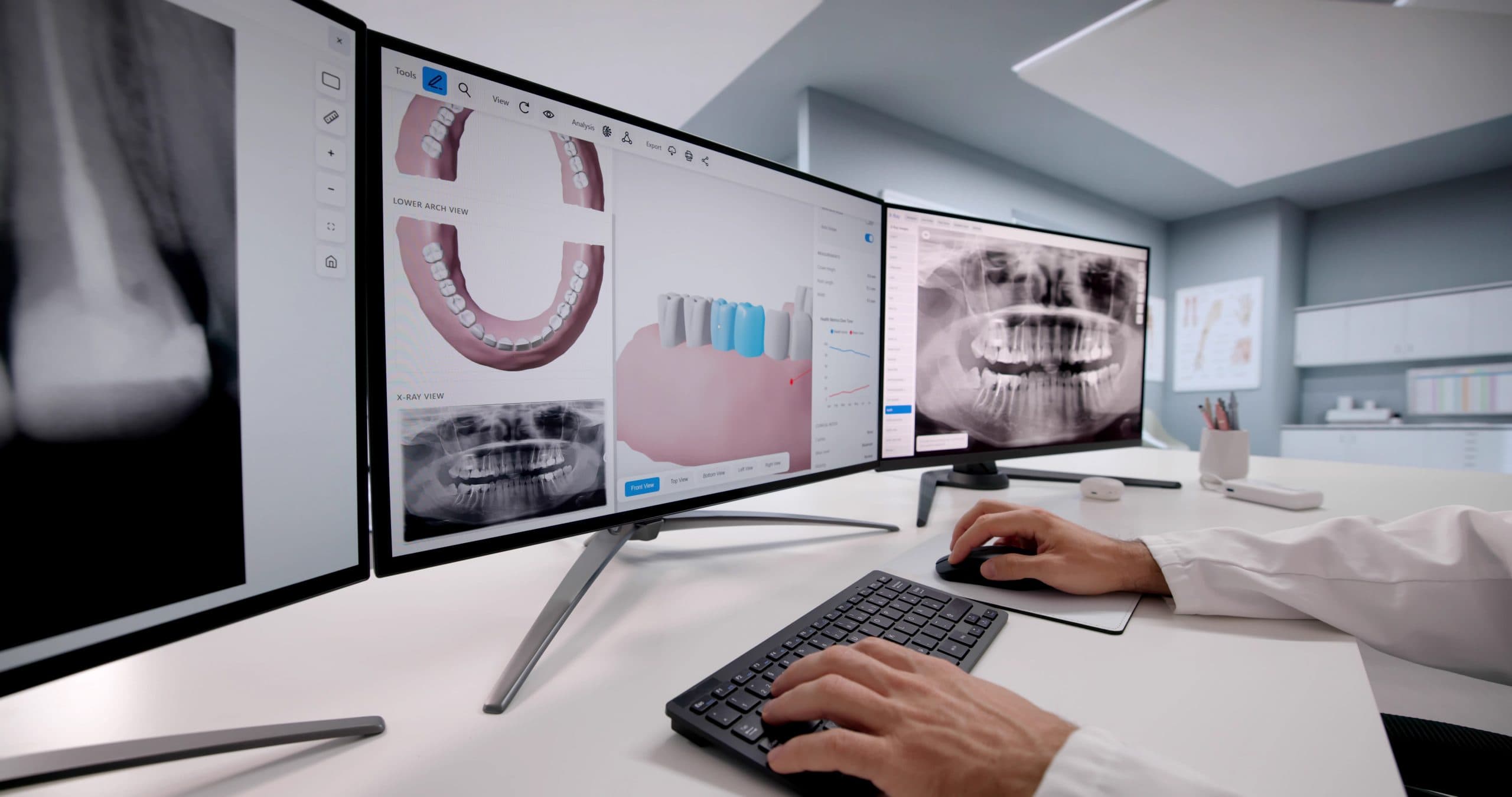 Dentist reviewing dental X-rays and a digital dental model on computer screens for digital dentistry treatment planning
