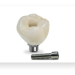 Screw retained